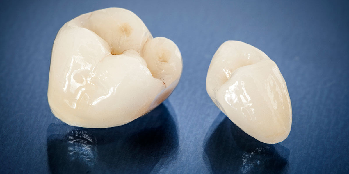 Porcelain Crowns