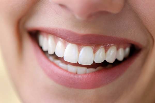 Tooth shade guide being held up to teeth